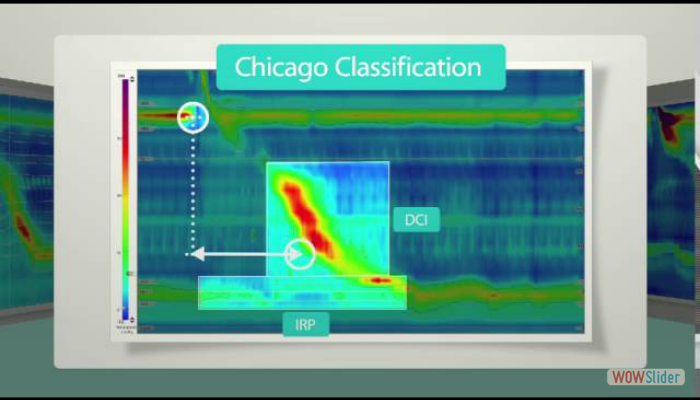 LABORIE High Resolution Manometry Theory